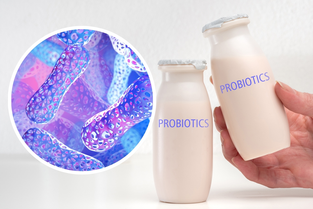 Probiotic-rich foods