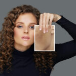 A woman with curly hair wearing a black top holds up an enlarged close-up image of skin showcasing hyperpigmentation and freckles next to her face, set against a plain gray background.